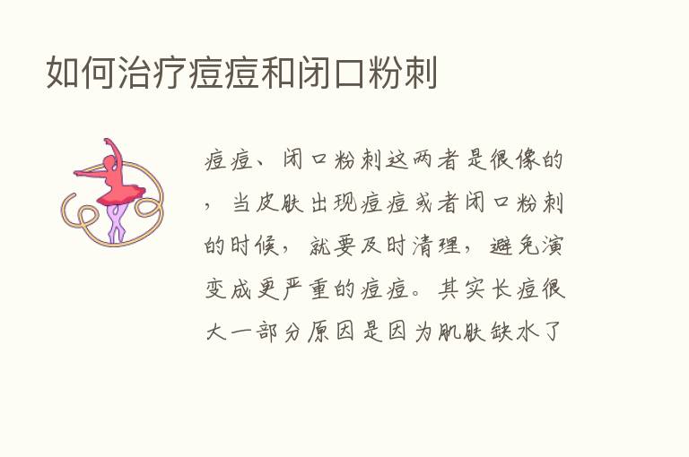 如何治疗痘痘和闭口粉刺