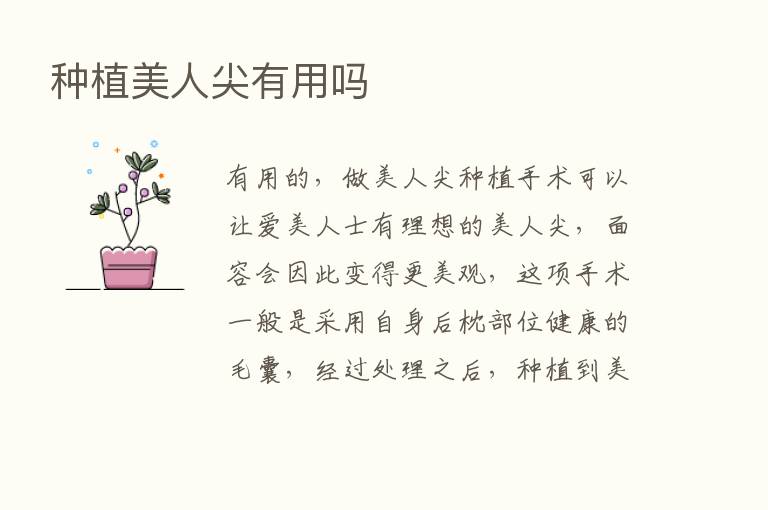 种植美人尖有用吗