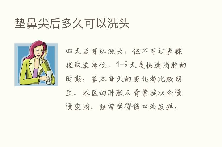 垫鼻尖后多久可以洗头