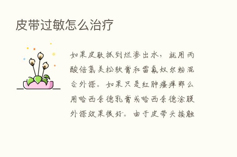 皮带过敏怎么治疗