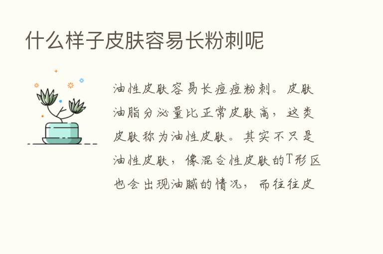 什么样子皮肤容易长粉刺呢