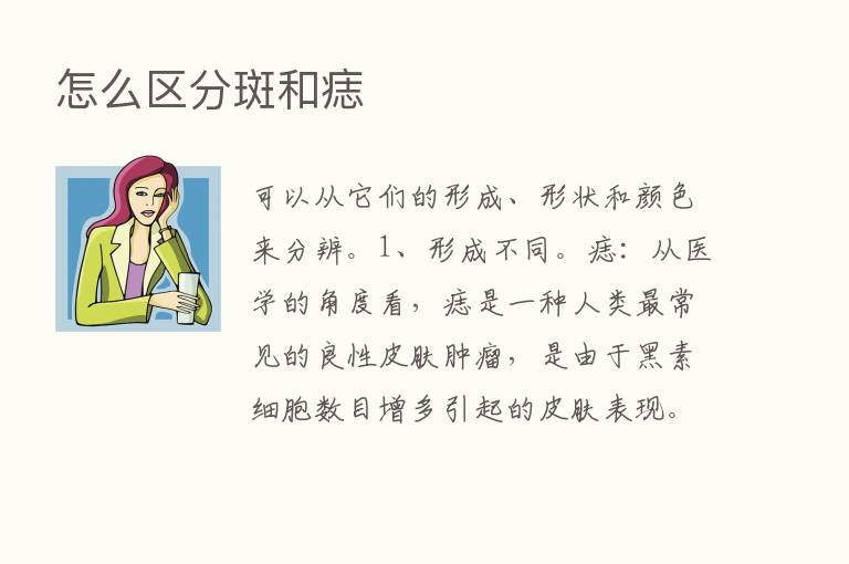 怎么区分斑和痣