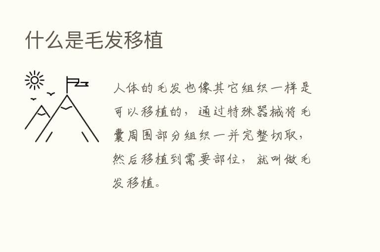 什么是毛发移植