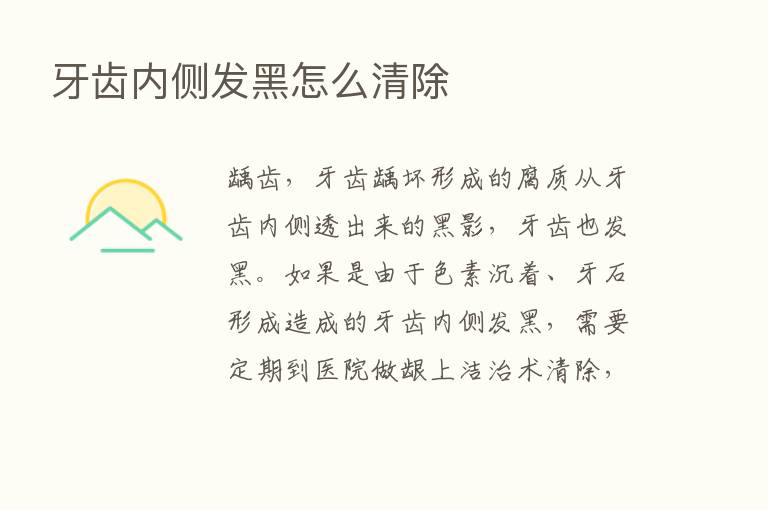 牙齿内侧发黑怎么清除