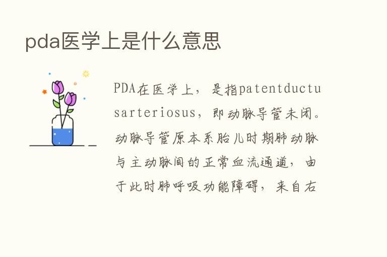 pda医学上是什么意思